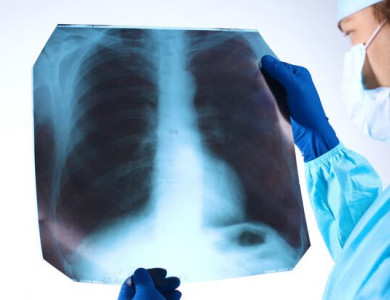 Абсцесс легкого: причины, симптомы, диагностика и лечение